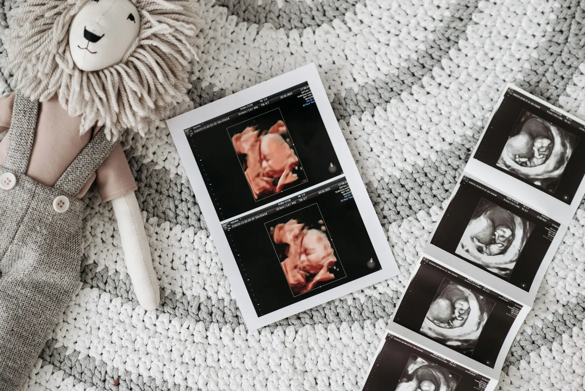 ultrasound picture